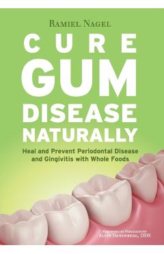 Cure Gum Disease Naturally: Heal Gingivitis and Periodontal Disease with Whole Foods - Ramiel Nagel