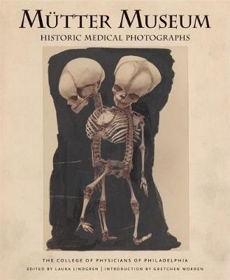 Mutter Museum Historic Medical Photographs: The College of Physicians of Philadelphia - Laura Lindgren