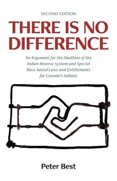 There Is No Difference: An Argument for the Abolition of the Indian Reserve System and Special Race-based Laws and Entitlements for Canada's I - Peter Best