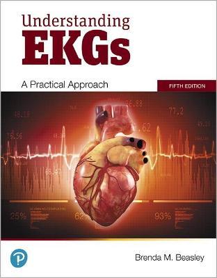 Understanding EKGs: A Practical Approach - Brenda Beasley
