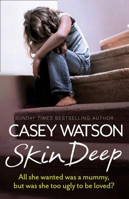 Skin Deep: All She Wanted Was a Mummy, But Was She Too Ugly to Be Loved? - Casey Watson