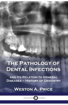 The Pathology of Dental Infections: and Its Relation to General Diseases - History of Dentistry - Weston A. Price