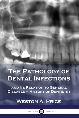 The Pathology of Dental Infections: and Its Relation to General Diseases - History of Dentistry - Weston A. Price