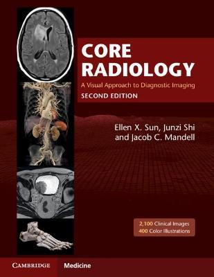 Core Radiology: A Visual Approach to Diagnostic Imaging - Ellen X. Sun