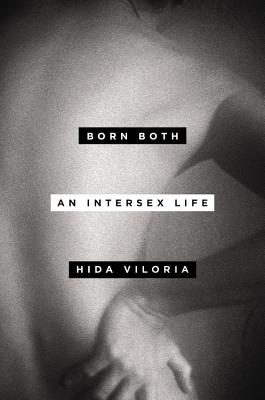 Born Both: An Intersex Life - Hida Viloria