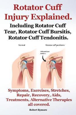 Rotator Cuff Injury Explained. Including Rotator Cuff Tear, Rotator Cuff Bursitis, Rotator Cuff Tendonitis. Symptoms, Exercises, Stretches, Repair, Re - Robert Rymore