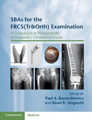 Sbas for the Frcs(tr&orth) Examination: A Companion to Postgraduate Orthopaedics Candidate's Guide - Paul A. Banaszkiewicz