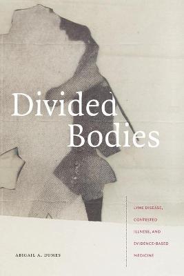 Divided Bodies: Lyme Disease, Contested Illness, and Evidence-Based Medicine - Abigail A. Dumes