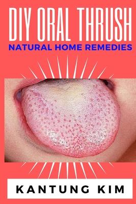 DIY Oral Thrush Natural Home Remedies: The Effective Step By Step Guide To Permanently End Oral Thrush - Kantung Kim
