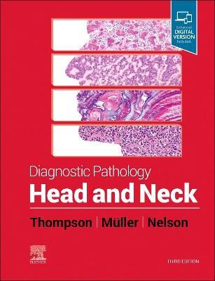 Diagnostic Pathology: Head and Neck - Lester D. R. Thompson