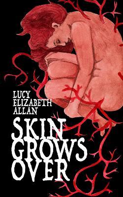 Skin Grows Over - Lucy Elizabeth Allan
