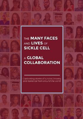 The Many Faces and Lives of Sickle Cell - A Global Collaboration - Agnes Nsofwa