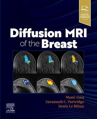 Diffusion MRI of the Breast - Mami Iima