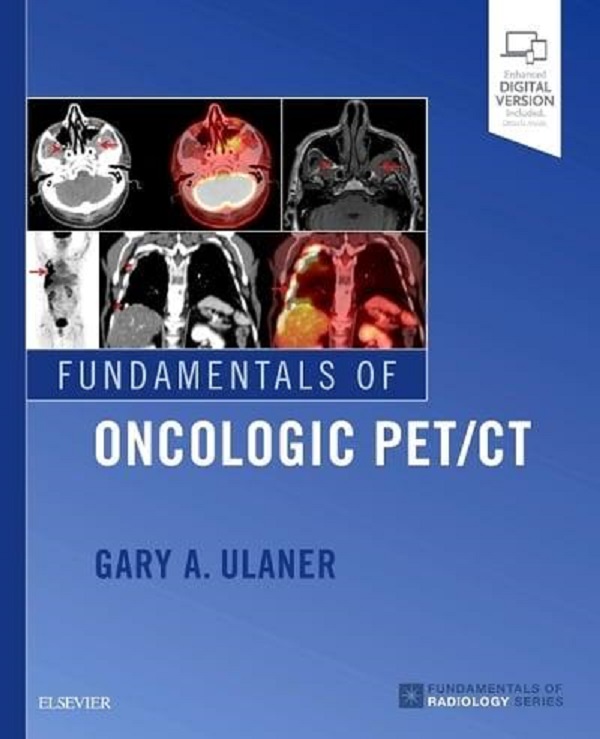 Fundamentals of Oncologic PET/CT - Gary Ulaner