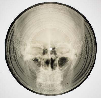Bone Music: Soviet X-Ray Audio - Stephen Coates