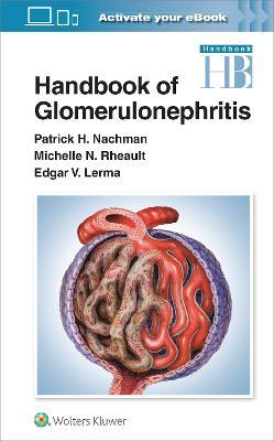 Handbook of Glomerulonephritis - Patrick Nachman