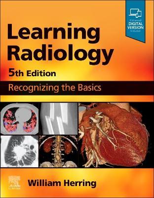 Learning Radiology: Recognizing the Basics - William Herring