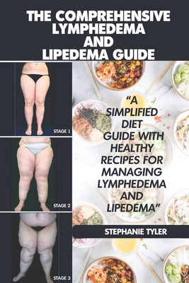 The Comprehensive Lymphedema and Lipedema Guide: The Comprehensive Lymphedema and Lipedema Guide - Stephanie Tyler