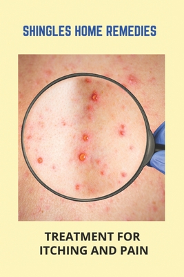 Shingles Home Remedies: Treatment For Itching And Pain: Shingles Recovery Stages - Katelin Quintero