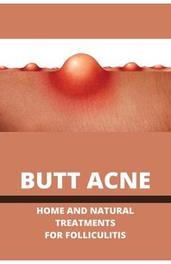 Coperta cărții 'Butt Acne: Home And Natural Treatments For Folliculitis: Barber'S Itch Home Remedies - Dalila Kua'
