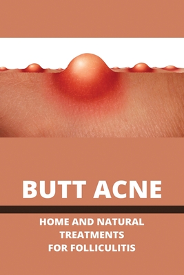 Butt Acne: Home And Natural Treatments For Folliculitis: Barber'S Itch Home Remedies - Dalila Kua