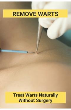 Poza produsului Remove Warts: Treat Warts Naturally Without Surgery: Boost Immune System To Get Rid Of Warts - Delicia Anda