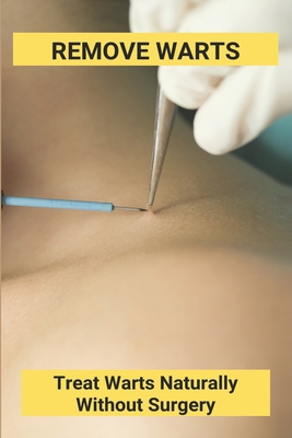 Remove Warts: Treat Warts Naturally Without Surgery: Boost Immune System To Get Rid Of Warts - Delicia Anda
