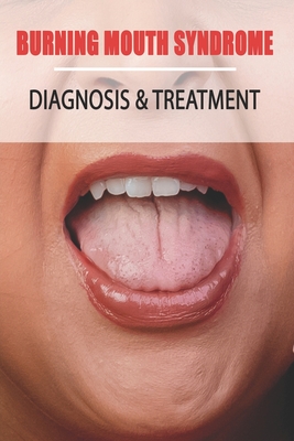 Burning Mouth Syndrome: Diagnosis & Treatment: Burning Mouth Syndrome Guide - Enoch Narciso