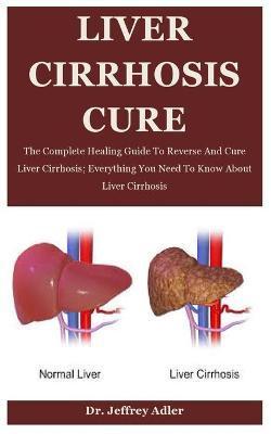 Liver Cirrhosis Cure: The Complete Healing Guide To Reverse And Cure Liver Cirrhosis; Everything You Need To Know About Liver Cirrhosis - Jeffrey Adler