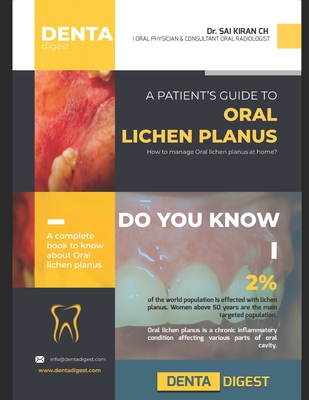 A patient's guide to Oral Lichen Planus - Chennoju Sai Kiran