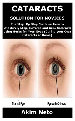 Cataracts Solution for Novices: The Step By Step Guide on How to Effectively Stop, Reverse and Cure Cataracts Using Herbs for Your Eyes (Curing your O - Akim Neto