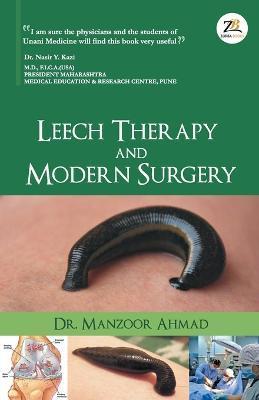 Leech Therapy & Modern Surgery - Manzoor Ahmed