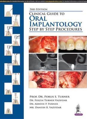 Clinical Guide to Oral Implantology: Step by Step Procedures - Porus S. Turner