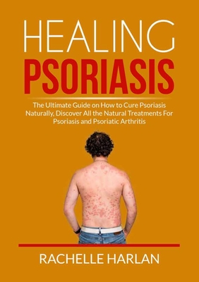 Healing Psoriasis: The Ultimate Guide on How to Cure Psoriasis Naturally, Discover All the Natural Treatments For Psoriasis and Psoriatic - Rachelle Harlan