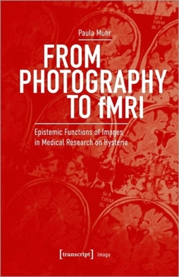 From Photography to Fmri: Epistemic Functions of Images in Medical Research on Hysteria - 