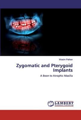 Zygomatic and Pterygoid Implants - Wasim Pathan