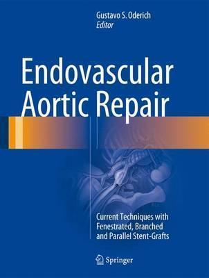 Endovascular Aortic Repair: Current Techniques with Fenestrated, Branched and Parallel Stent-Grafts - Gustavo S. Oderich