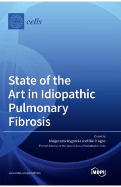Coperta cărții 'State of the Art in Idiopathic Pulmonary Fibrosis - Malgorzata Wygrecka'