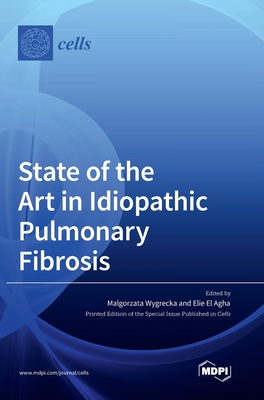 Coperta cărții 'State of the Art in Idiopathic Pulmonary Fibrosis - Malgorzata Wygrecka'