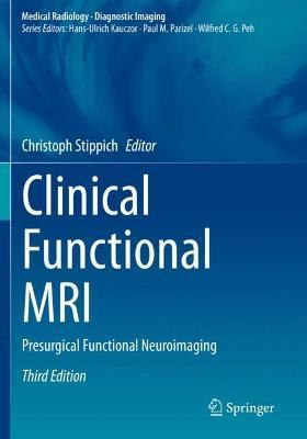 Clinical Functional MRI: Presurgical Functional Neuroimaging - Christoph Stippich