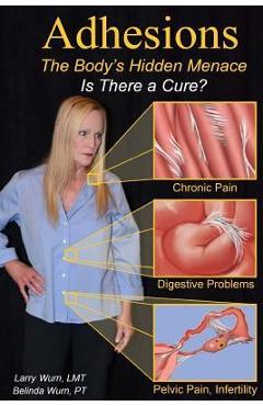 Poza produsului Adhesions: The Body's Inner Menace - Is There a Cure? - Belinda Wurn Pt