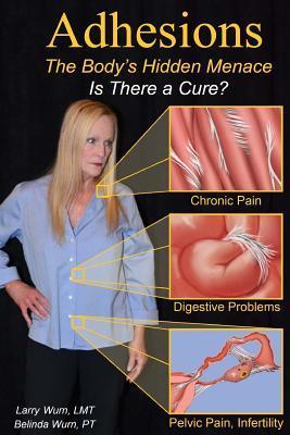 Adhesions: The Body's Inner Menace - Is There a Cure? - Belinda Wurn Pt