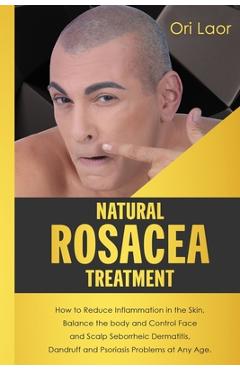 Coperta cărții 'Natural Rosacea Treatment: How to Reduce Inflammation in the Skin, Balance the body and Control Face and Scalp'