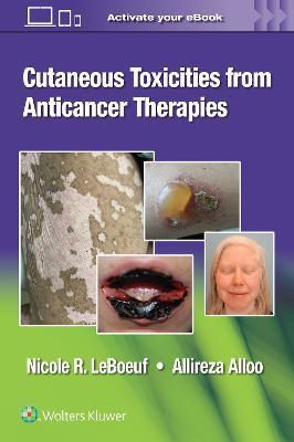 Cutaneous Reactions from Anti-Cancer Therapies - Allireza Alloo