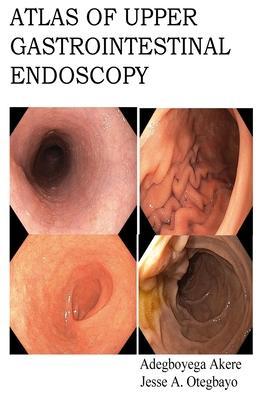 Atlas of Upper Gastrointestinal Endoscopy - Jesse Abiodun Otegbayo