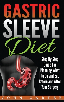 Gastric Sleeve Diet: Step By Step Guide For Planning What to Do and Eat Before and After Your Surgery - John Carter