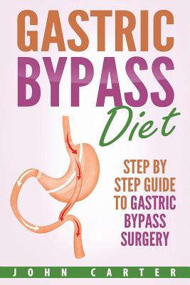 Gastric Bypass Diet: Step By Step Guide to Gastric Bypass Surgery - John Carter