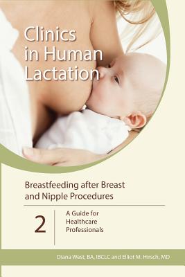 Coperta cărții 'Breastfeeding after Breast and Nipple Procedures: A Guide for Healthcare Professionals - Elliot M. Hirsch'