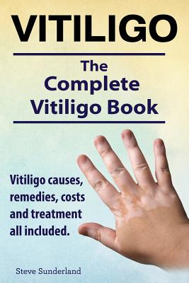 Vitiligo. Vitiligo causes, remedies, costs and treatment all included. The complete Vitiligo Book. - Steve Sunderland