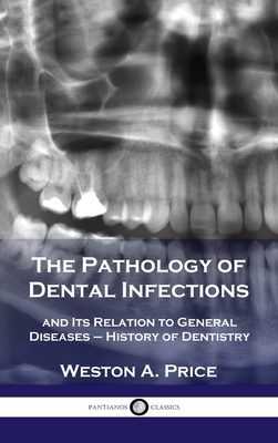 Pathology of Dental Infections: and Its Relation to General Diseases - History of Dentistry - Weston A. Price